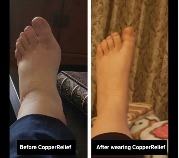 Copper Relief Socks pregnancy